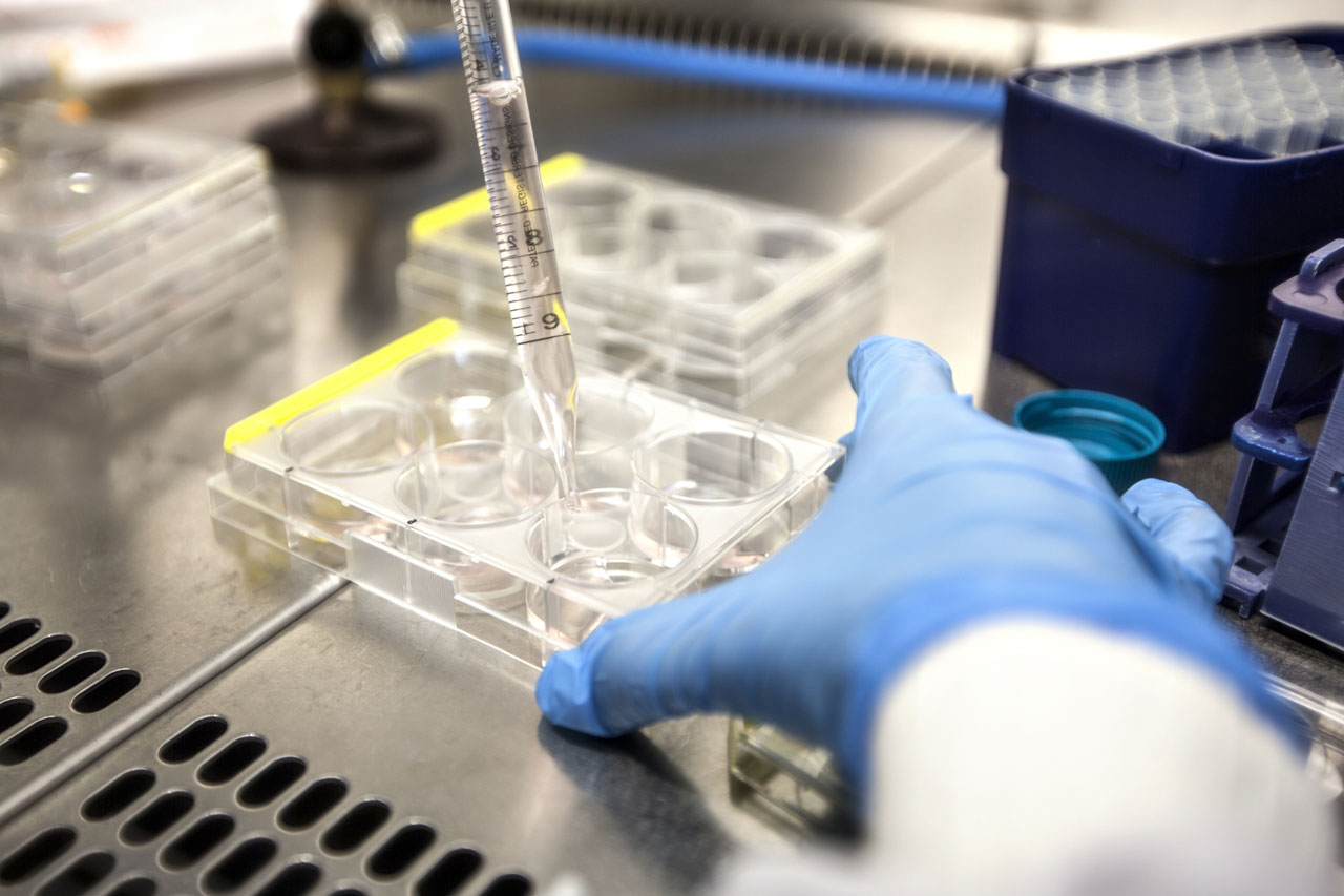 Tüp Bebek Laboratuvarlarında Doğru Sarf Malzeme Seçimi